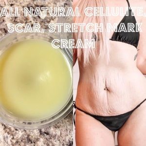 Natural Scar, Cellulite & Stretch Mark Cream